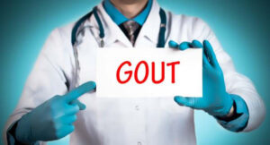bệnh gout có nguy hiểm không