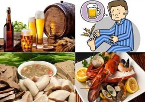 Nguyên nhân chính của bệnh gout là do sự tích tụ axit uric trong máu