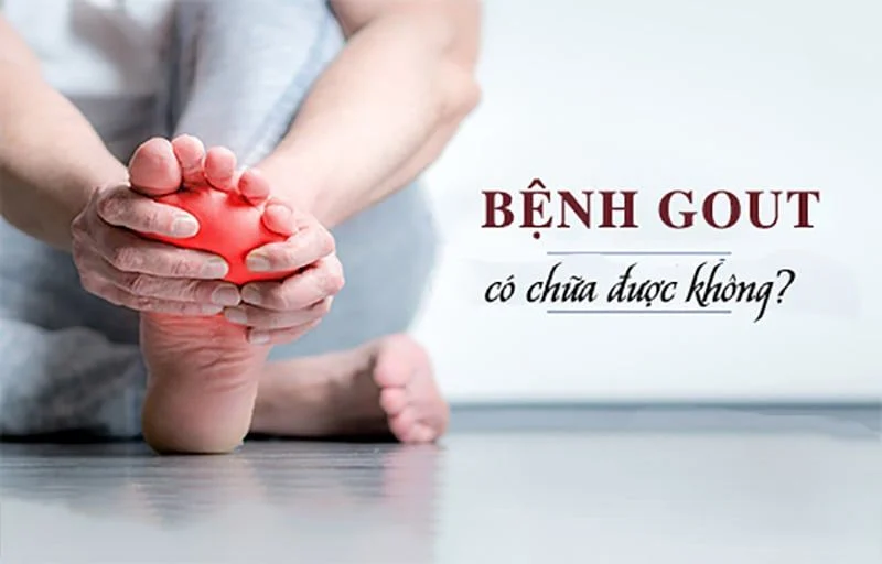 Bệnh gout có chữa được không?