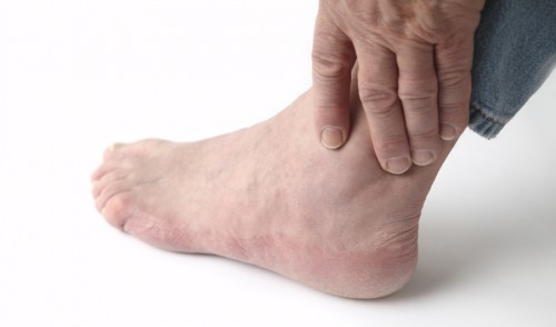 Đau khớp do gout khác gì với thoái hóa về nguyên nhân?