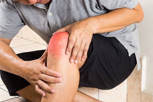 Đau Gout Có Cần Chườm Nóng