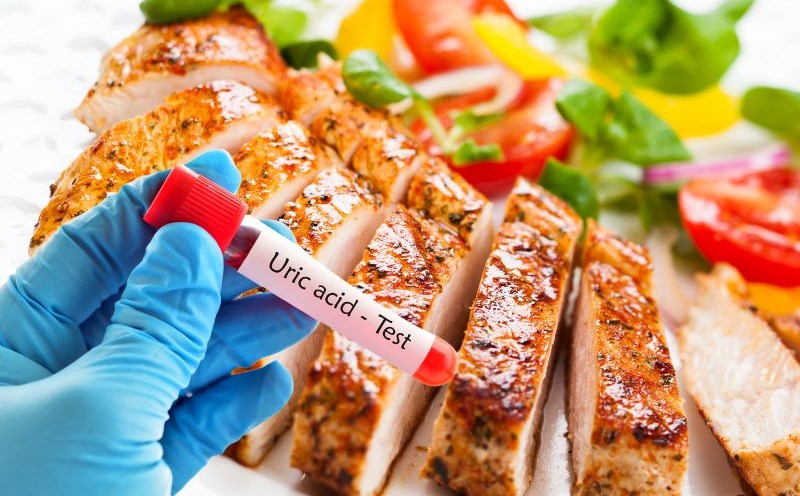 Bệnh Gout Có Lây Qua Ăn Uống Không