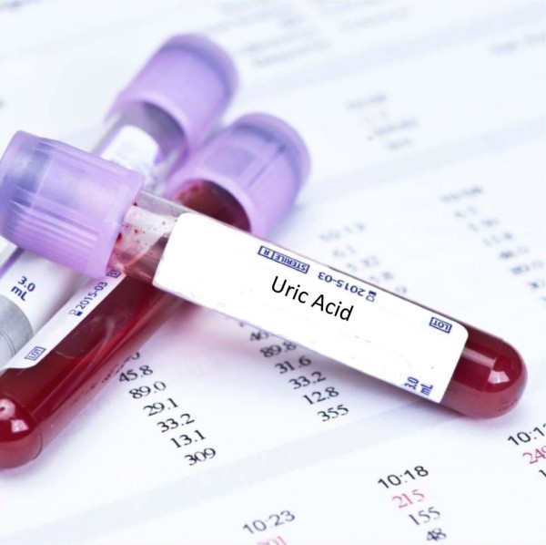 Acid uric bao nhiêu là gout