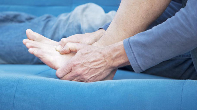 Dấu Hiệu Bệnh Gút Và Các Cấp Độ Phát Triển