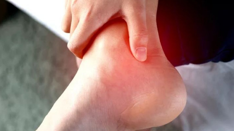 Thuốc giảm đau gout cấp