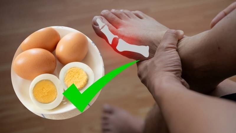 Người Bị Gout Có Ăn Được Trứng Gà Không?
