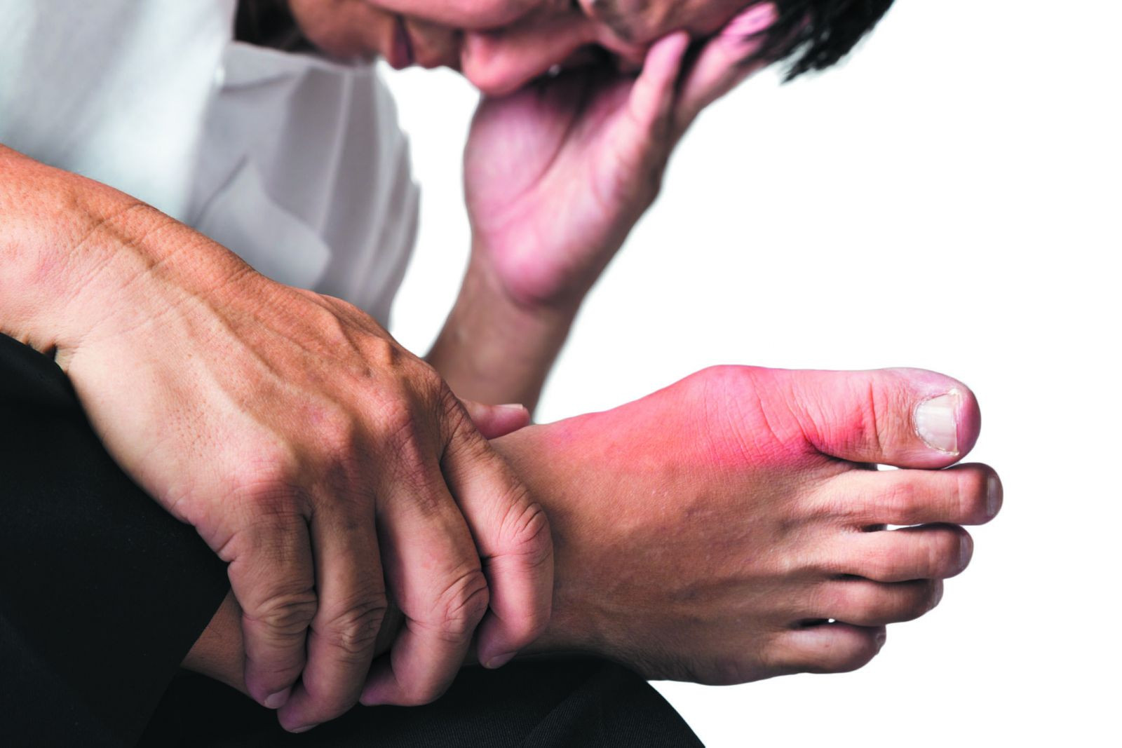 Gout Ảnh Hưởng Đến Não Như Thế Nào?