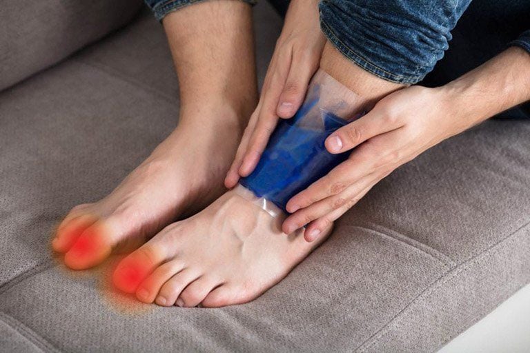Một cơn gout cấp thường kéo dài bao lâu