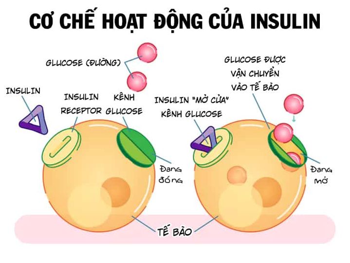 Kháng insulin gây gout như thế nào?