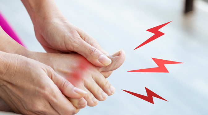 Gout kéo dài bao lâu thì hết đau