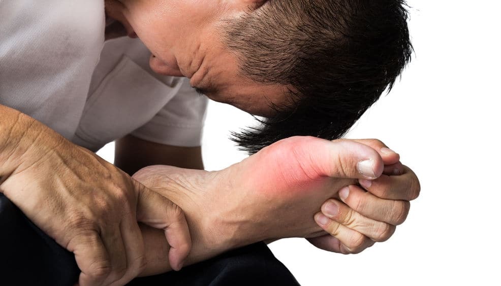 Vì sao người gầy vẫn bị gout?