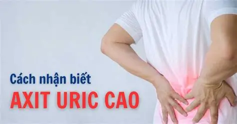 Axit uric tăng nhẹ có cần điều trị không