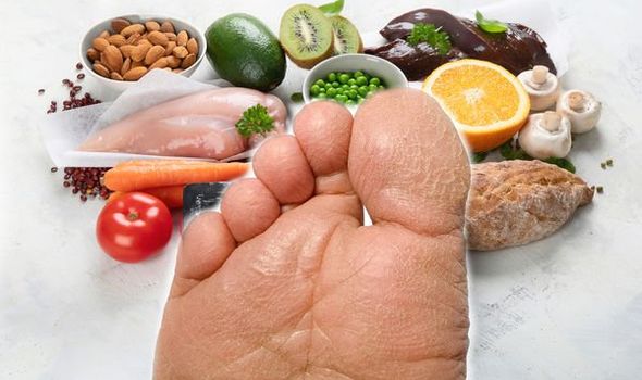 Người bị gout có nên ăn nhiều rau không