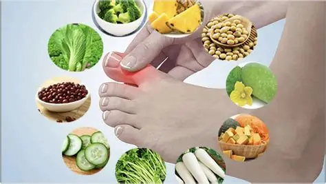 gout nên ăn gì và kiêng gì để hạn chế cơn đau