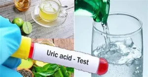 Uống nước có giảm axit uric không