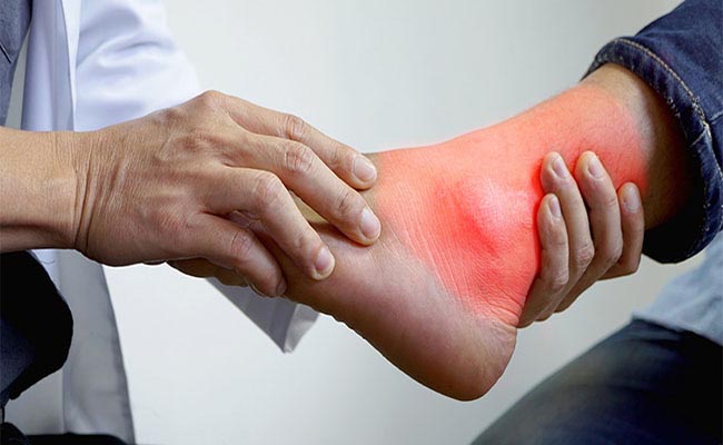 câu hỏi gout có nguy hiểm không