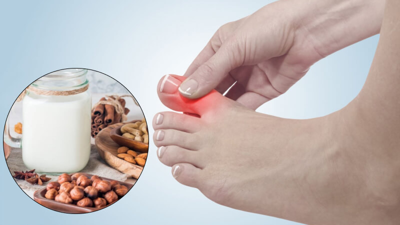 người bị gout hoàn toàn có thể uống sữa, thậm chí nếu chọn đúng loại